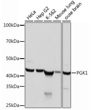 PGK1 Rabbit Monoclonal Antibody