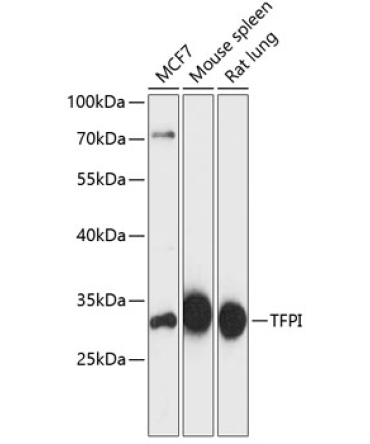 TFPI Rabbit Polyclonal Antibody