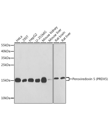 Peroxiredoxin 5 (PRDX5) Rabbit Polyclonal Antibody