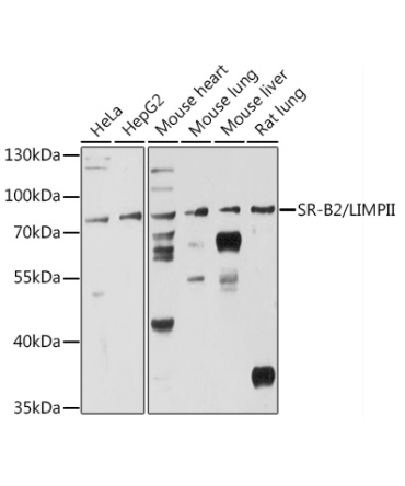SR-B2/LIMPII Rabbit Polyclonal Antibody