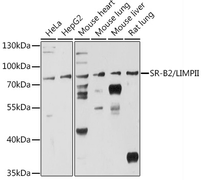 SR-B2/LIMPII Rabbit Polyclonal Antibody