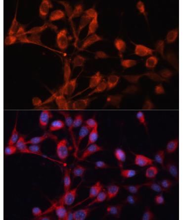 SLC25A19 Rabbit Polyclonal Antibody