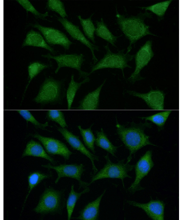 TRIM45 Rabbit Polyclonal Antibody