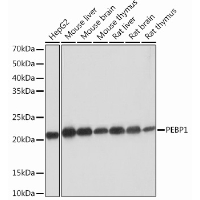 PEBP1 Rabbit Monoclonal Antibody