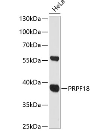 PRPF18 Rabbit Polyclonal Antibody