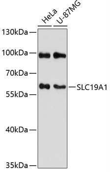 SLC19A1 Rabbit Polyclonal Antibody