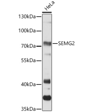SEMG2 Rabbit Polyclonal Antibody
