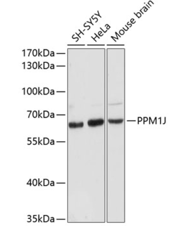 PPM1J Rabbit Polyclonal Antibody