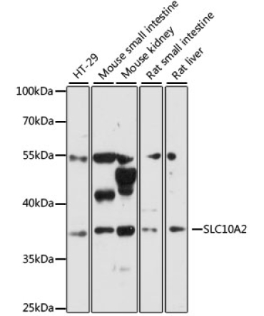 SLC10A2 Rabbit Polyclonal Antibody