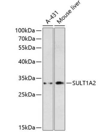 SULT1A2 Rabbit Polyclonal Antibody