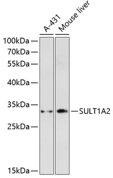 SULT1A2 Rabbit Polyclonal Antibody