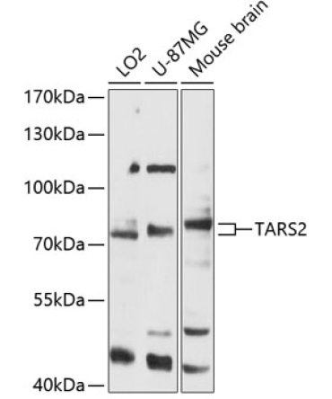 TARS2 Rabbit Polyclonal Antibody