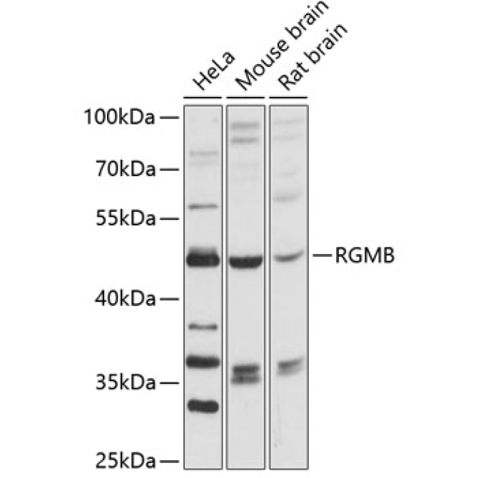 RGMB Rabbit Polyclonal Antibody