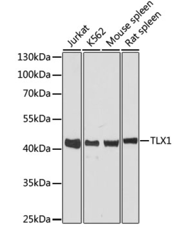 TLX1 Rabbit Polyclonal Antibody