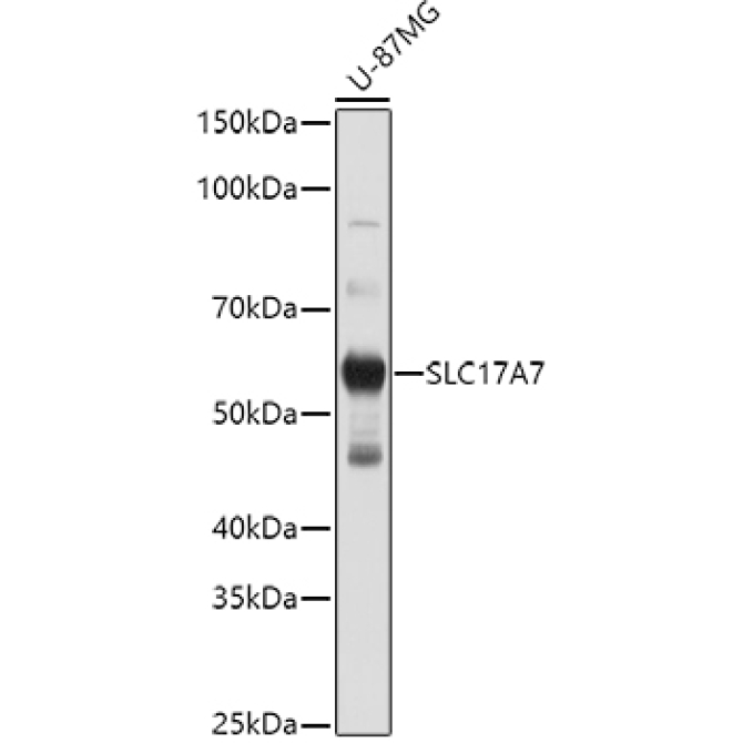 SLC17A7 Rabbit Polyclonal Antibody