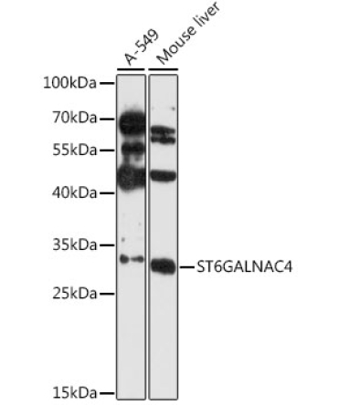 ST6GALNAC4 Rabbit Polyclonal Antibody