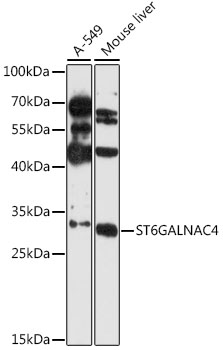 ST6GALNAC4 Rabbit Polyclonal Antibody