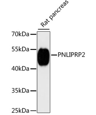 PNLIPRP2 Rabbit Polyclonal Antibody