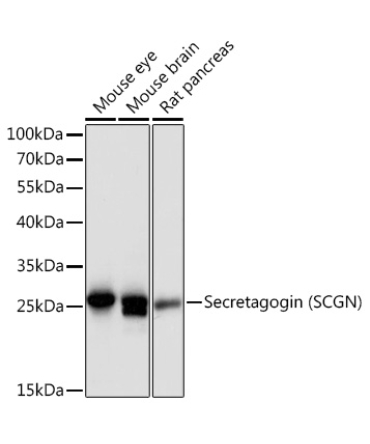 Secretagogin (SCGN) Rabbit Polyclonal Antibody