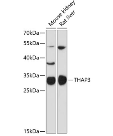 THAP3 Rabbit Polyclonal Antibody