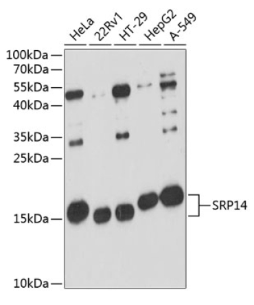 SRP14 Rabbit Polyclonal Antibody