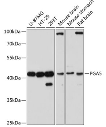 PGA5 Rabbit Polyclonal Antibody