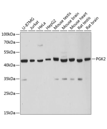 PGK2 Rabbit Polyclonal Antibody
