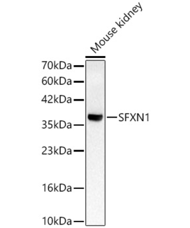 SFXN1 Rabbit Polyclonal Antibody