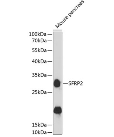 SFRP2 Rabbit Polyclonal Antibody