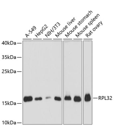 RPL32 Rabbit Polyclonal Antibody