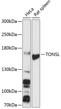 TONSL Rabbit Polyclonal Antibody