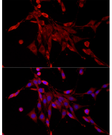 PDE4C Rabbit Polyclonal Antibody