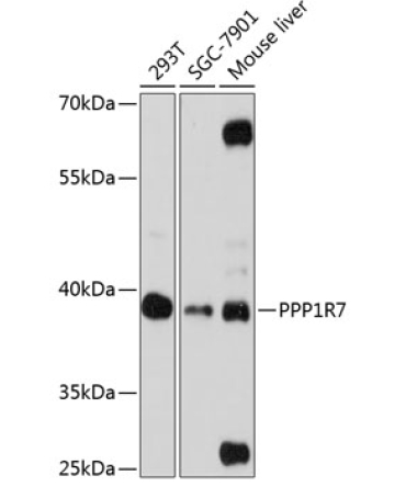 PPP1R7 Rabbit Polyclonal Antibody