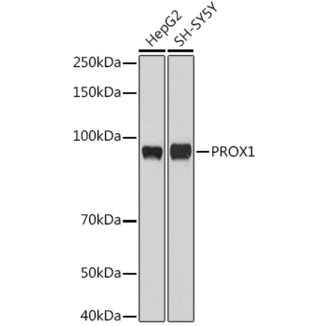 PROX1 Rabbit Polyclonal Antibody