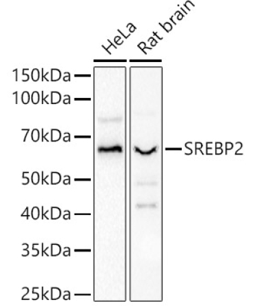 SREBP2 Rabbit Polyclonal Antibody