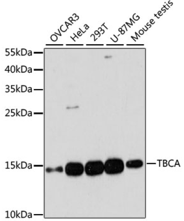 TBCA Rabbit Polyclonal Antibody