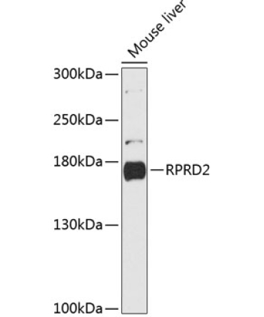 RPRD2 Rabbit Polyclonal Antibody