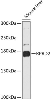 RPRD2 Rabbit Polyclonal Antibody