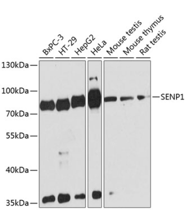 SENP1 Rabbit Polyclonal Antibody