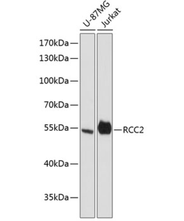 RCC2 Rabbit Polyclonal Antibody