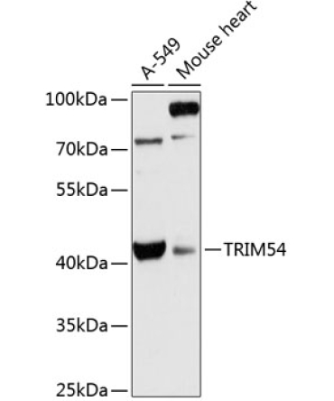TRIM54 Rabbit Polyclonal Antibody