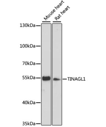 TINAGL1 Rabbit Polyclonal Antibody