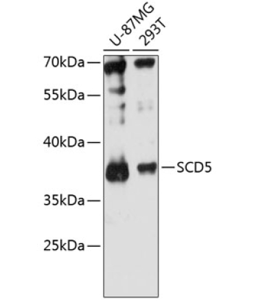 SCD5 Rabbit Polyclonal Antibody