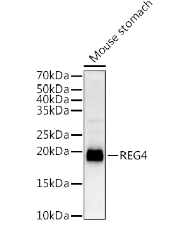 REG4 Rabbit Polyclonal Antibody