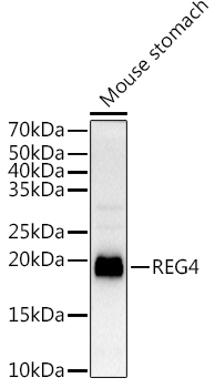 REG4 Rabbit Polyclonal Antibody