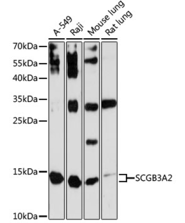 SCGB3A2 Rabbit Polyclonal Antibody