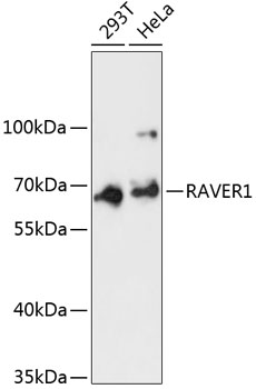 RAVER1 Rabbit Polyclonal Antibody