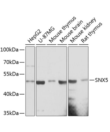 SNX5 Rabbit Polyclonal Antibody