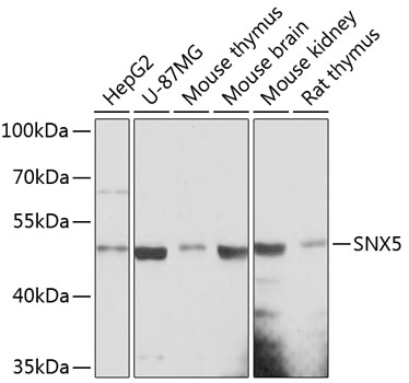 SNX5 Rabbit Polyclonal Antibody