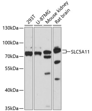 SLC5A11 Rabbit Polyclonal Antibody